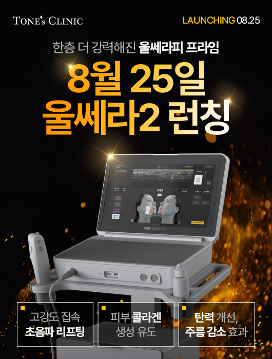 팝업